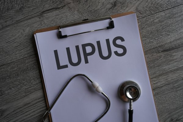 Comment reconnaître et traiter une poussée de lupus érythémateux systémique ?